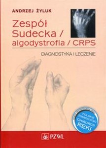 Picture of Zespół Sudecka / Algodystrofia / CRPS Diagnostyka i leczenie
