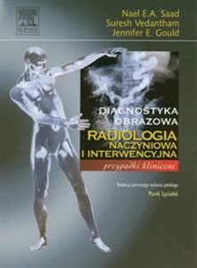 Picture of Radiologia naczyniowa i interwencyjna Przypadki kliniczne