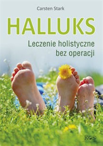 Picture of Halluks Leczenie holistyczne bez operacji