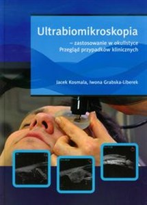 Obrazek Ultrabiomikroskopia - zastosowanie w okulistyce Przegląd przypadków klinicznych