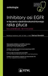 Obrazek Inhibitory osi EGFR w leczeniu nie drobnokomórkowego raka płuca W gabinecie lekarza specjalisty Najnowsze wytyczne