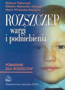 Obrazek Rozszczep wargi i podniebienia