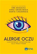 polish book : Alergie oc... - Ewa Bogacka, Anna Groblewska, Marta Chełmińska