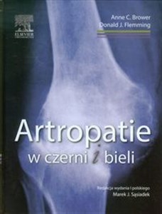 Picture of Artropatie w czerni i bieli