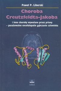 Picture of Choroba Creutzfeldta-Jakoba I inne choroby wywołane przez priony - pasażowalne encefalopatie gąbczaste człowieka