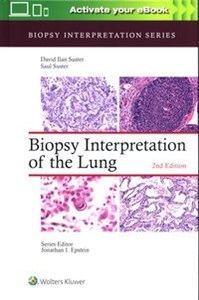 Obrazek Biopsy Interpretation of the Lung Second edition