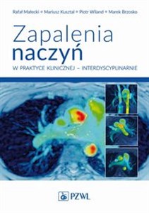 Obrazek Zapalenia naczyń w praktyce klinicznej interdyscyplinarnie Diagnostyka i leczenie