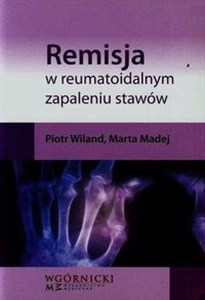Picture of Remisja w reumatoidalnym zapaleniu stawów