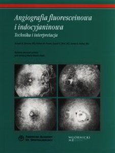 Picture of Angiografia fluoresceinowa i indocyjaninowa Technika i interpretacja