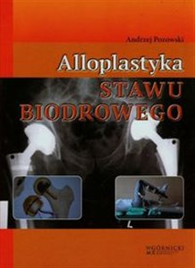 Picture of Alloplastyka stawu biodrowego