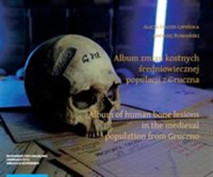 Obrazek Album zmian kostnych średniowiecznej populacji z Gruczna Album of human bone lesions in the medieva