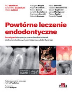 Picture of Powtórne leczenie endodontyczne