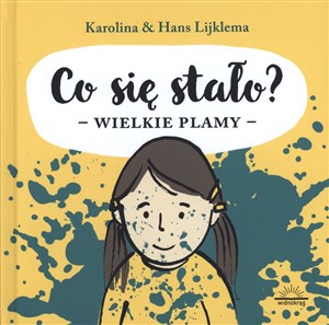 Obrazek Co się stało? Wielkie plamy