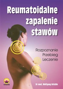 Picture of Reumatoidalne zapalenie stawów