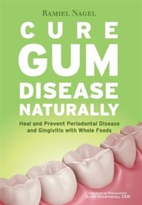 Obrazek Cure Gum Disease Naturally Heal Gingivitis and Periodontal Disease with Whole Foods