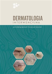 Obrazek Dermatologia interwencyjna