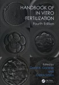 Picture of Handbook of In Vitro Fertilization