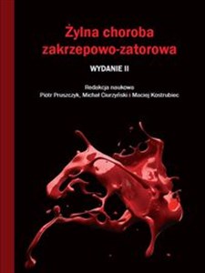 Picture of Żylna choroba zakrzepowo-zatorowa