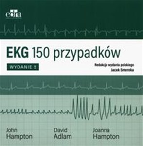 Picture of EKG 150 przypadków