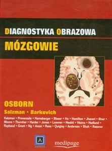 Picture of Diagnostyka obrazowa Mózgowie