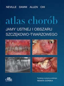 Obrazek Atlas chorób jamy ustnej i obszaru szczękowo-twarzowego