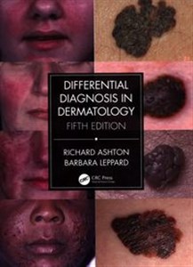 Obrazek Differential Diagnosis in Dermatology