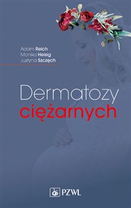 Obrazek Dermatozy ciężarnych