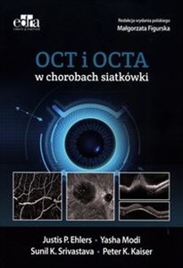 Obrazek OCT i OCTA w chorobach siatkówki