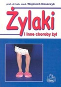 polish book : Żylaki i i... - Wojciech Noszczyk