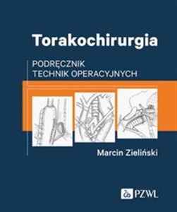 Picture of Torakochirurgia Podręcznik technik operacyjnych