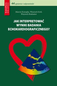 Picture of Jak interpretować wyniki badania echokardiograficznego