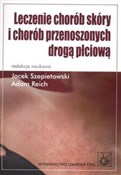 Leczenie c... - Jacek Szepietowski, Adam Reich -  foreign books in polish 