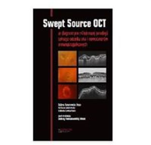 Obrazek Swept Source OCT w diagnostyce patologii tylnego bieguna oka i nowotworów wewnątrzgałkowych