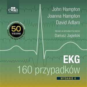 Obrazek EKG 160 przypadków