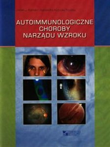 Picture of Autoimmunologiczne choroby narządu wzroku