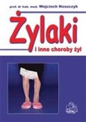 Żylaki i i... - Wojciech Noszczyk -  Polish Bookstore 