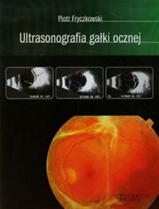 Obrazek Ultrasonografia gałki ocznej