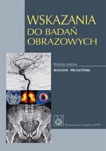 Obrazek Wskazania do badań obrazowych