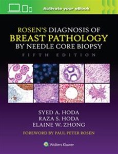 Picture of Rosen's Diagnosis of Breast Pathology by Needle Core Biopsy