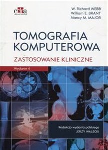 Obrazek Tomografia komputerowa Zastosowanie kliniczne