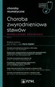 Choroba zw... -  foreign books in polish 