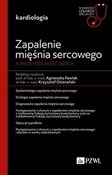 Zapalenie ... - Agnieszka Pawlak, Krzysztof Ozierański -  Polish Bookstore 