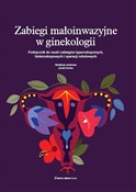 polish book : Zabiegi ma... - Jacek Doniec