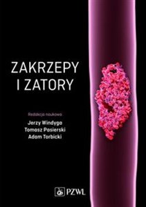 Picture of Zakrzepy i zatory