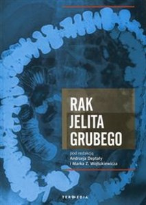 Obrazek Rak jelita grubego