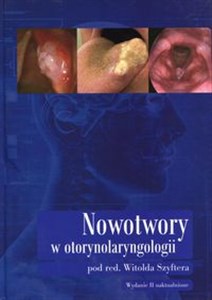 Picture of Nowotwory w otorynolaryngologii