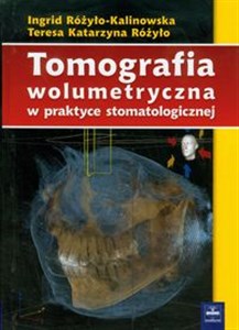 Obrazek Tomografia wolumetryczna w praktyce stomatologicznej