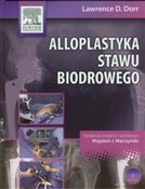 Alloplasty... - Lawrence D. Dorr -  Polish Bookstore 