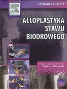 Obrazek Alloplastyka stawu biodrowego z płytą DVD