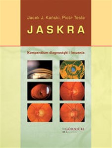 Obrazek Jaskra Kompendium diagnostyki i leczenia
